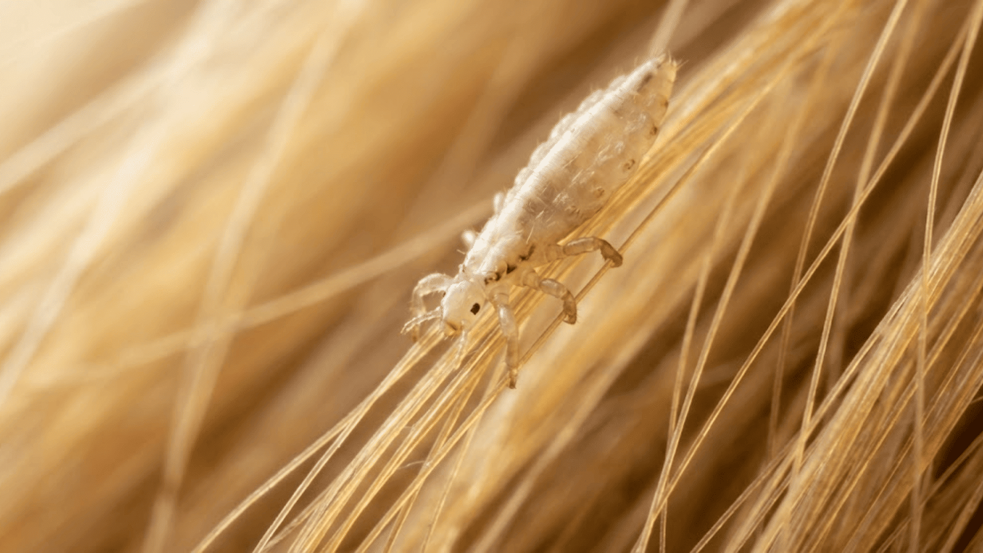 head louse on blonde hair with narrow body and claws gripping hair strands