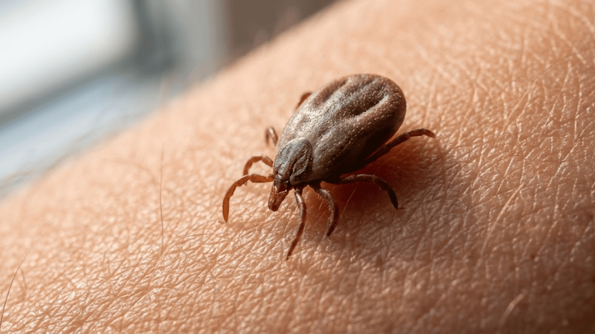 brown tick with eight legs on skin showing teardrop shape different from bed bug
